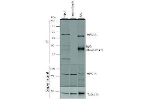Immunoprecipitation analysis using Mouse Anti-VPS35 Monoclonal Antibody, Clone 8A3 (ABIN6932974).