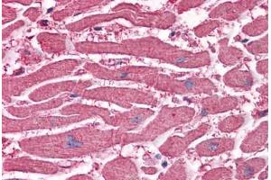 Human Heart: Formalin-Fixed, Paraffin-Embedded (FFPE)