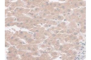 IHC-P analysis of Human Liver Tissue, with DAB staining. (SYNE2 anticorps  (AA 6-296))