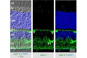 Indirect immunostaining of mouse retina (dilution 1 : 500).