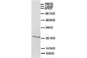 Western blot analysis of rat brain tissue lysis using SHH antibody (Sonic Hedgehog anticorps  (N-Term))