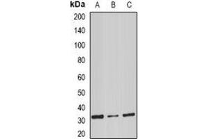 Western blot analysis of Stomatin expression in mouse spleen (A), mouse heart (B), rat liver (C) whole cell lysates. (Stomatin anticorps)