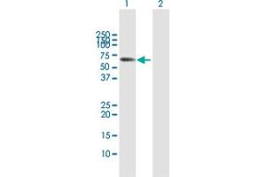 Western Blot analysis of MPP2 expression in transfected 293T cell line by MPP2 MaxPab polyclonal antibody. (MPP2 anticorps  (AA 1-552))
