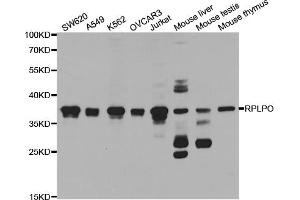 Western blot analysis of extracts of various cell lines, using RPLP0 antibody (ABIN5973238) at 1/1000 dilution. (RPLP0 anticorps)