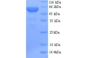 SDS-PAGE (SDS) image for SWI/SNF Related, Matrix Associated, Actin Dependent Regulator of Chromatin, Subfamily A, Member 4 (SMARCA4) (AA 700-1246), (partial) protein (His tag) (ABIN5713846)