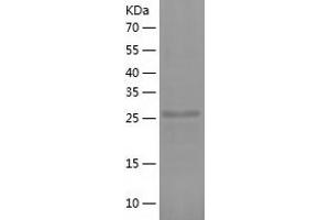 Western Blotting (WB) image for Nucleophosmin (Nucleolar phosphoprotein B23, Numatrin) (NPM1) (AA 1-292) protein (His-IF2DI Tag) (ABIN7124224)