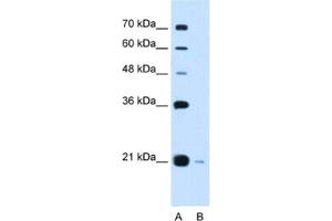 Western Blotting (WB) image for anti-DCTP Pyrophosphatase 1 (DCTPP1) antibody (ABIN2462972) (DCTPP1 anticorps)