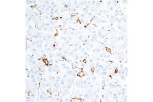 Immunohistochemistry (IHC) image for anti-CD163 (CD163) (AA 850-900) antibody (ABIN7448890)