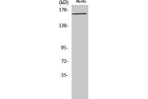 Western Blot (WB) analysis of specific cells using Phospho-Flk-1 (Y1175) Polyclonal Antibody.