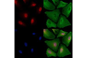 ABIN6259146 and ABIN6273735 staining  cells by IF/ICC. (PAX4 anticorps  (Internal Region))