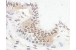 Immunohistochemistry (IHC) image for anti-B-Cell CLL/lymphoma 11B (Zinc Finger Protein) (BCL11B) (AA 500-550) antibody (ABIN7454621) (BCL11B anticorps  (AA 500-550))