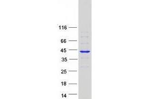 Validation with Western Blot