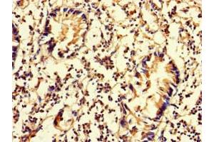 Immunohistochemistry of paraffin-embedded human appendix tissue using ABIN7150849 at dilution of 1:100 (DNAAF3 anticorps  (AA 1-209))