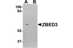 Western blot analysis of ZBED3 in human lung tissue lysate with this product at 1 μg/ml in (A) the absence and (B) the presence of blocking peptide. (ZBED3 anticorps  (C-Term))