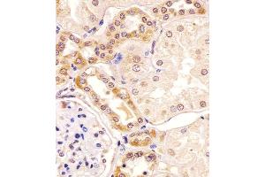 Antibody staining PKC beta1/2 in human kidney tissue sections by Immunohistochemistry (IHC-P - paraformaldehyde-fixed, paraffin-embedded sections). (PKC beta1/2 (AA 303-334) anticorps)