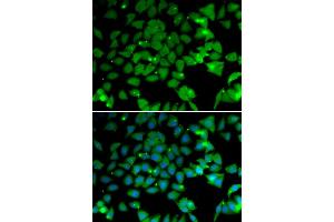 Immunofluorescence analysis of U2OS cells using NAA10 antibody (ABIN5974216).