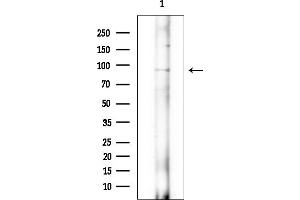 Western blot analysis of lysates from EC304 cells(heat-shock treatment), using RHG6 Antibody at 1/1000 dilution. (RHG6 (Internal Region) anticorps)