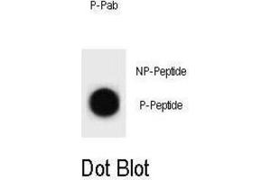 Dot Blot (DB) image for anti-Cyclin B2 (CCNB2) (pThr359) antibody (ABIN3002075) (Cyclin B2 anticorps  (pThr359))