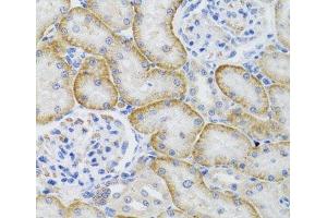 Immunohistochemistry of paraffin-embedded Rat kidney using ARFGAP1 Polyclonal Antibody at dilution of 1:100 (40x lens). (ARFGAP1 anticorps)