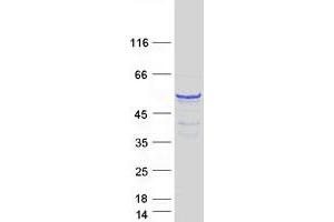 Validation with Western Blot
