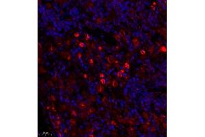 Immunofluorescence of paraffin embedded rat spleen using BCMA (ABIN7076067) at dilution of 1: 600 (450x lens)