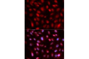 Immunofluorescence analysis of U2OS cells using SUMO2 antibody. (SUMO2 anticorps)