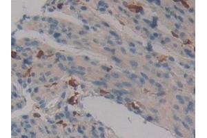 Detection of F13A1 in Mouse Ovary Tissue using Polyclonal Antibody to Coagulation Factor XIII A1 Polypeptide (F13A1)