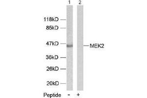 Image no. 1 for anti-Mitogen-Activated Protein Kinase Kinase 2 (MAP2K2) (Thr394) antibody (ABIN197107) (MEK2 anticorps  (Thr394))