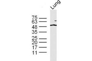 Lane 1: mouse lung lysates probed with 	TAZ Polyclonal Antibody, Unconjugated  at 1:300 overnight at 4˚C. (TAZ anticorps  (AA 1-100))