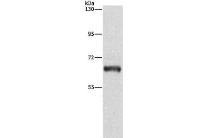 Western Blot analysis of Lovo cell using KLC1 Polyclonal Antibody at dilution of 1:500 (KLC1 anticorps)
