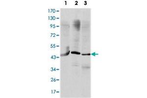 Western blot analysis using OTX2 monoclonal antobody, clone 1H12G8B2  against HepG2 (1), Jurkat (2), and NTERA-2 (3) cell lysate. (OTX2 anticorps)