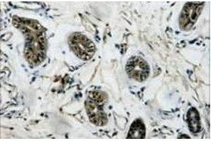 Immunohistochemistry of paraffin-embedded Human colon tissue using beta Tubulin Monoclonal Antibody at dilution of 1:200. (TUBB anticorps)