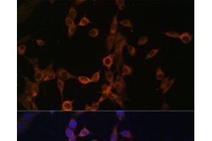Immunofluorescence analysis of NIH/3T3 cells using PPP3R1 Polyclonal Antibody at dilution of 1:100. (PPP3R1 anticorps)