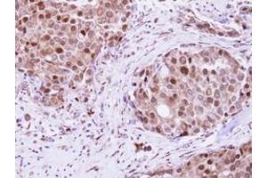 anti-RAD23 Homolog B (RAD23B) (AA 164-409) antibody