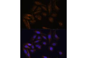 Immunofluorescence analysis of U-2 OS cells using TF antibody (ABIN7270888) at dilution of 1:100. (TFAP4 anticorps)
