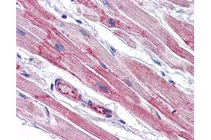 Anti-RWDD3 antibody IHC of human heart.