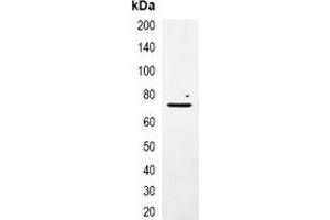 anti-mCherry Fluorescent Protein antibody