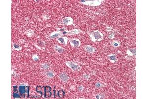 ABIN5539681 (5µg/ml) staining of paraffin embedded Human Cortex.