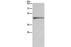 Western Blot analysis of Mouse heart tissue using IL5RA Polyclonal Antibody at dilution of 1:650 (IL5RA anticorps)