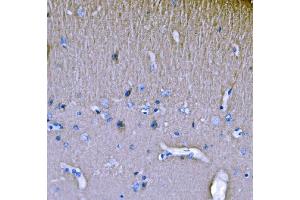 IHC analysis of SH3GL2 using anti-SH3GL2 antibody (ABIN7602229). (SH3G2 anticorps  (AA 65-292))