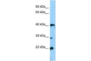 WB Suggested Anti-Gm13152 Antibody Titration: 1. (Zfp982 anticorps  (N-Term))