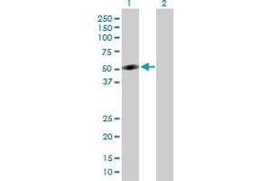 Western Blot analysis of CRLF1 expression in transfected 293T cell line by CRLF1 MaxPab polyclonal antibody.