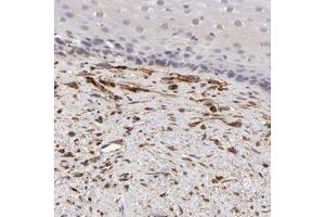 Immunohistochemical staining of human esophagus with SPARC polyclonal antibody  shows distinct positivity in fibroblasts. (SPARC anticorps)