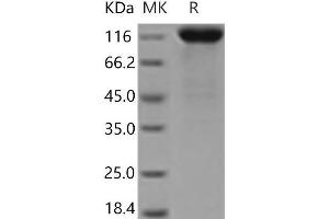Western Blotting (WB) image for Leukemia Inhibitory Factor Receptor alpha (LIFR) (Active) protein (His tag) (ABIN7321130)