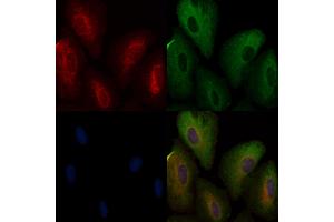 ABIN6257946 and ABIN6274871 staining  cells by IF/ICC. (Ataxin 2-Like anticorps  (Internal Region))