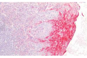 Detection of DGKa in Human Tonsil Tissue using Polyclonal Antibody to Diacylglycerol Kinase Alpha (DGKa) (DGKA anticorps  (AA 305-531))