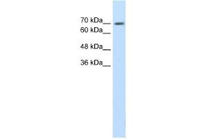 WB Suggested Anti-EPS8L1 Antibody Titration:  1. (EPS8-Like 1 anticorps  (N-Term))
