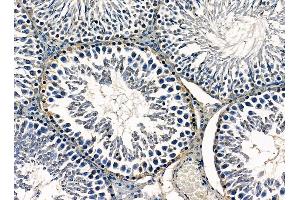 ABIN7095319 and ABIN7099376 at 1/100 staining rat testis tissue by IHC-P. (P4HA3 anticorps)