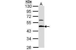 WB Image Sample (30 ug of whole cell lysate) A: A431 , 10% SDS PAGE antibody diluted at 1:1000 (APBB3 anticorps  (Center))