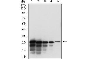 Western blot analysis using SARS-CoV-2-NP3 mAb against human SARS-CoV-2-N (AA: 240-419) recombinant protein. (SARS-CoV-2-NP3 (AA 240-419) anticorps)